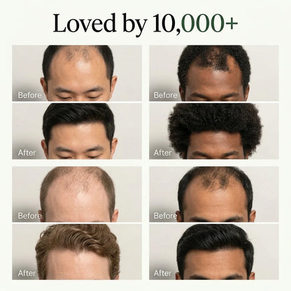 Korean Scalp Revival Bar